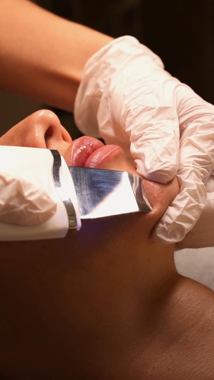 Limpieza facial con espátula ultrasónica, manos con guantes sobre el rostro
